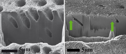 Patching up tooth enamel